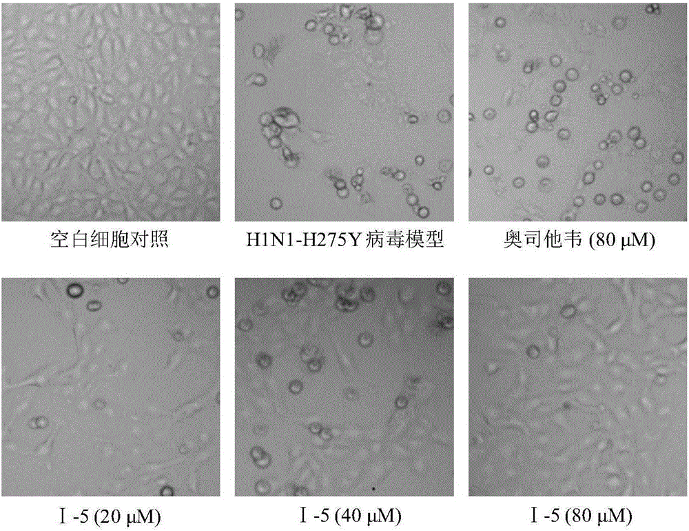 Benzoic acid triazole anti-influenza-virus compounds as well as preparation method and application thereof