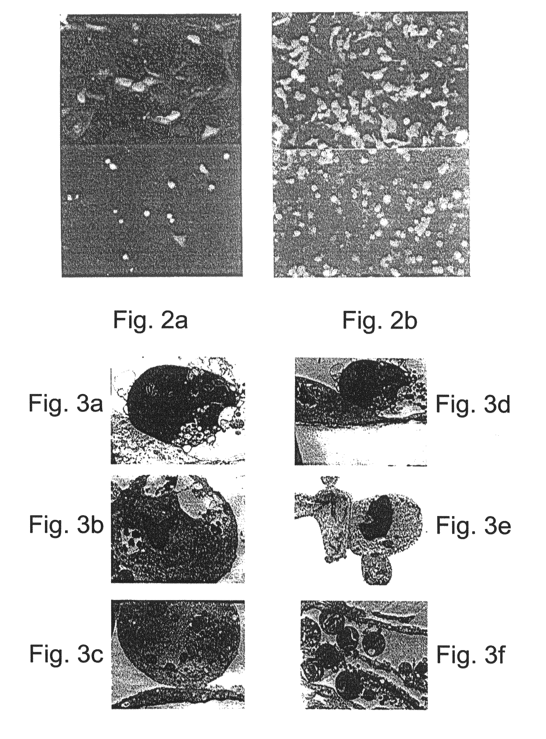 Promoters exhibiting endothelial cell specificity and methods of using same for regulation of angiogenesis