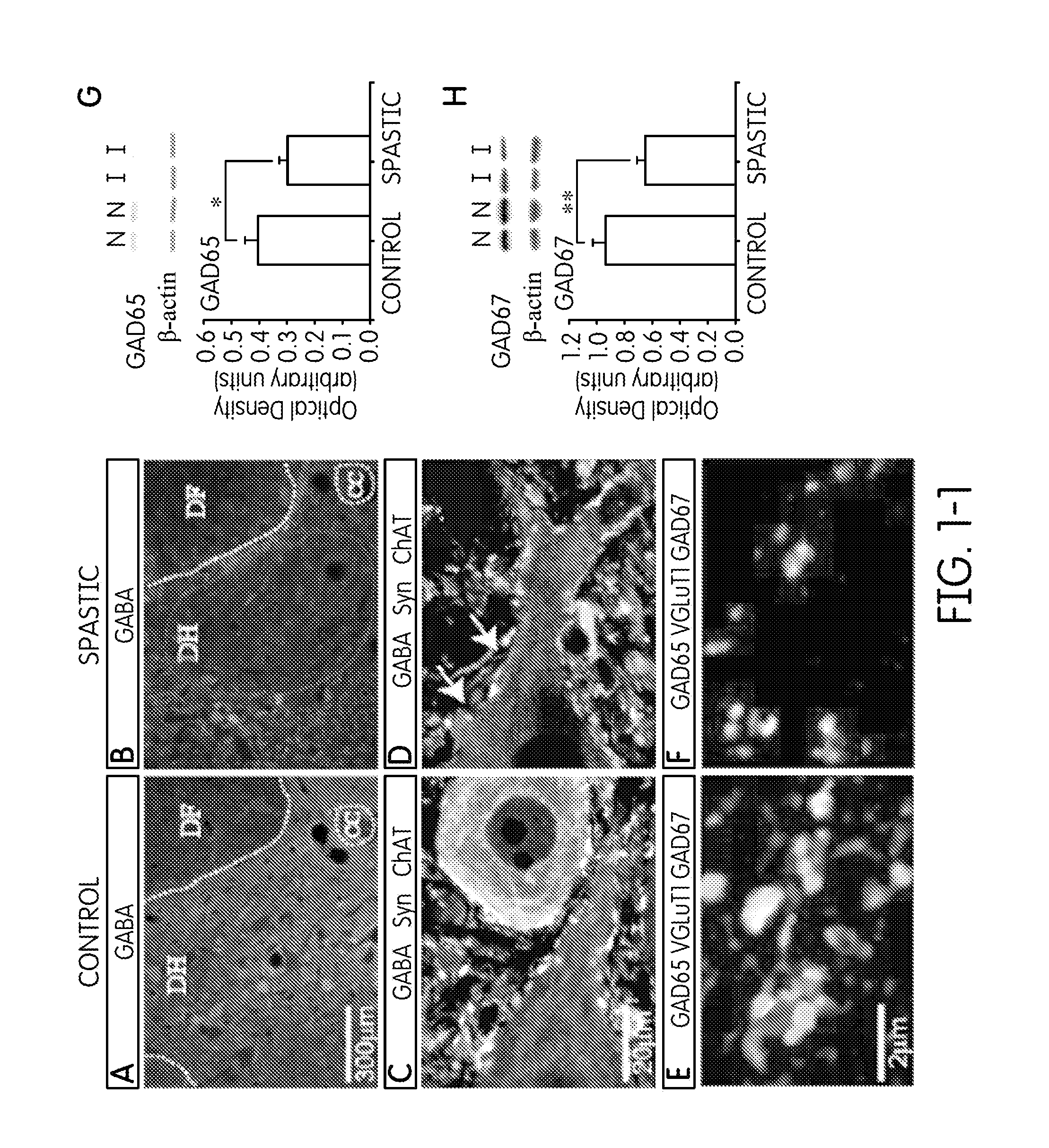 Method and composition for treating spasticity