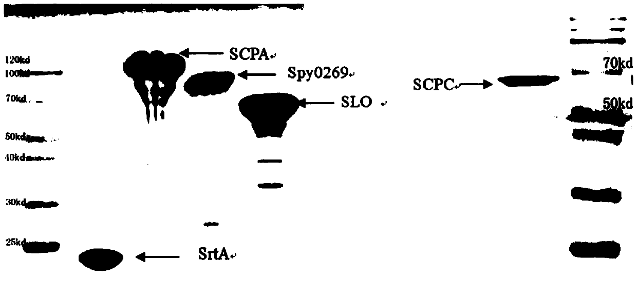 A broad-spectrum multiple subunit vaccine for preventing type a streptococcal infection