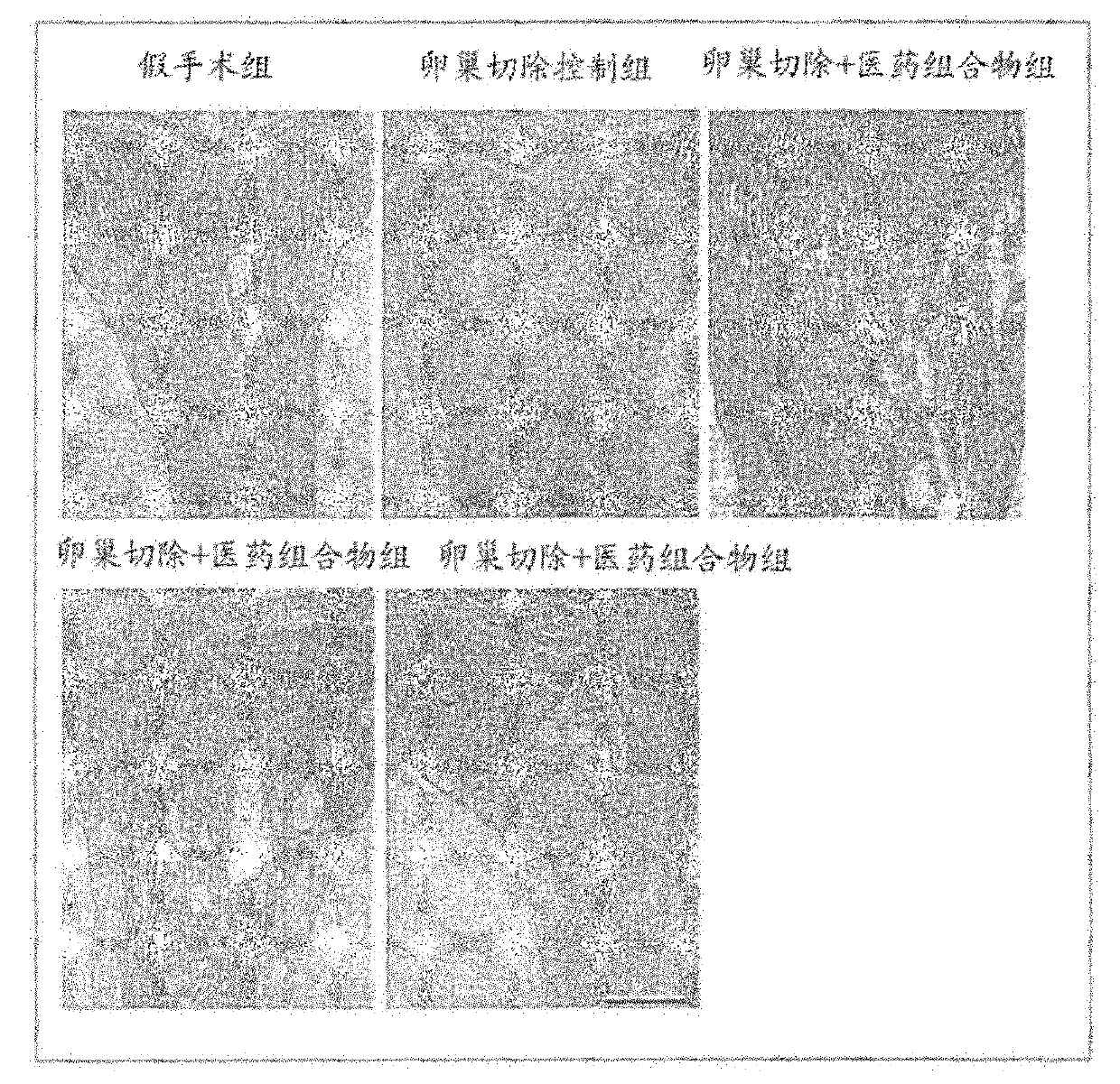 Pharmaceutical composition for preventing and/or treating bone loss