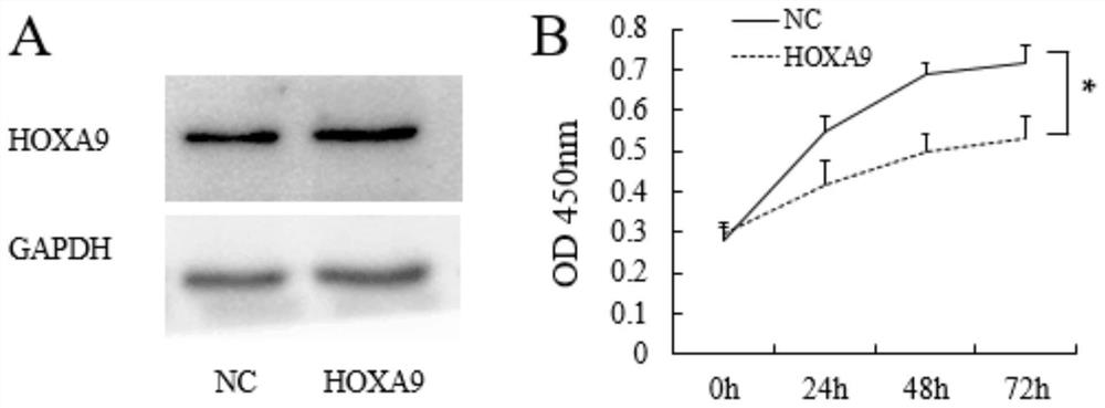 Application of hoxa9 gene in preparation of medicine for treating skin squamous cell carcinoma