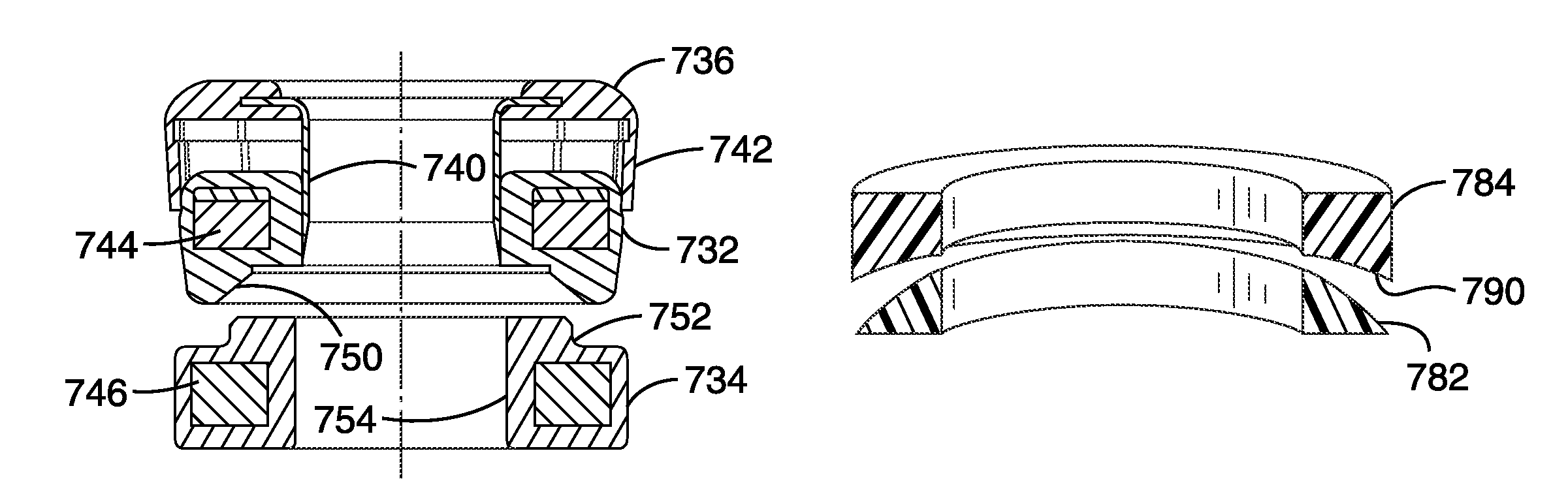 Apparatus and method for magnetic alteration of anatomical features