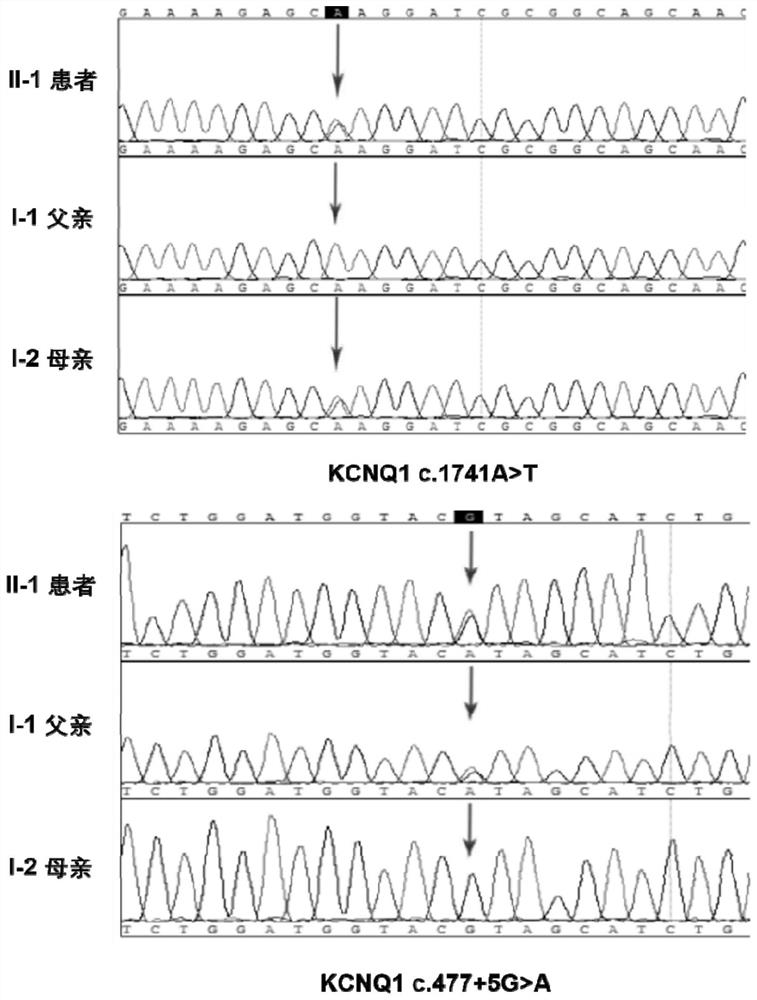 KCNQ1 gene mutant and use thereof