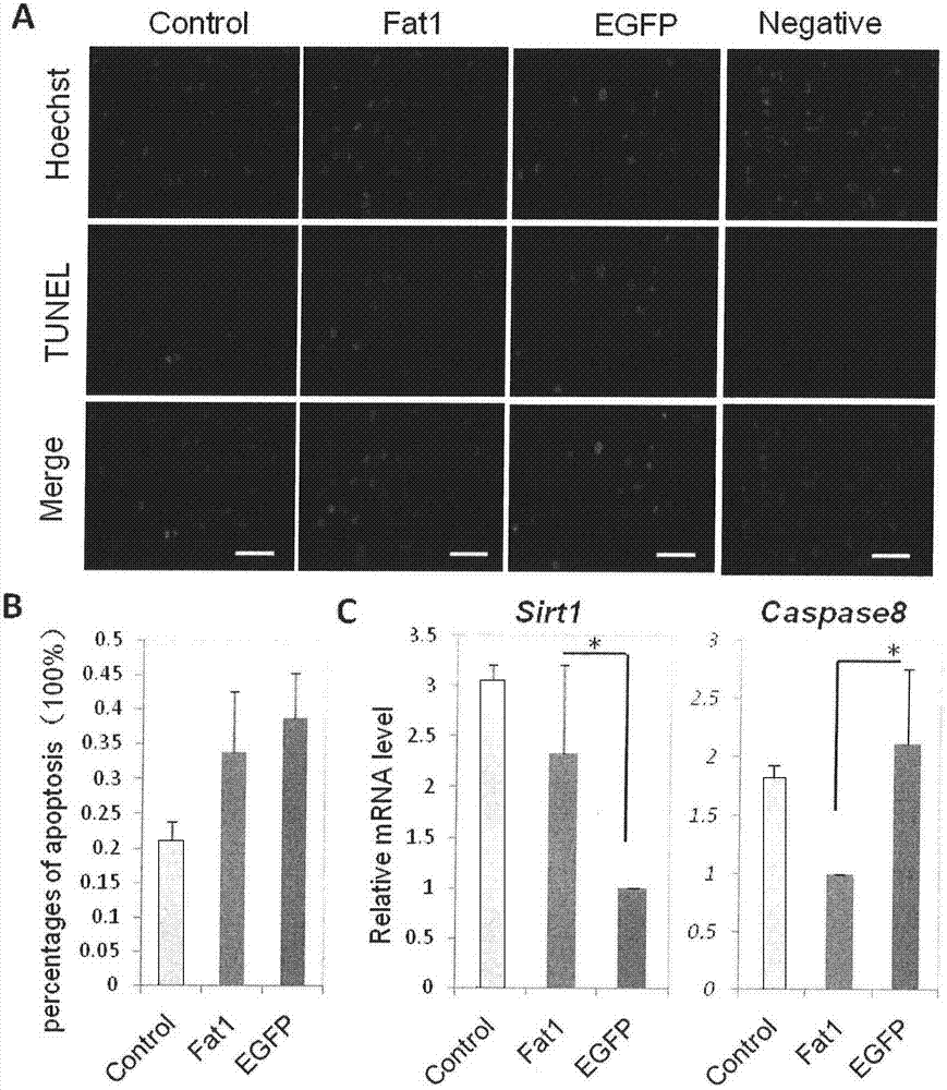 Method for synthesis, transfection and detection of anti-aging gene of goat