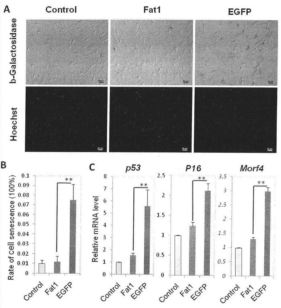 Method for synthesis, transfection and detection of anti-aging gene of goat