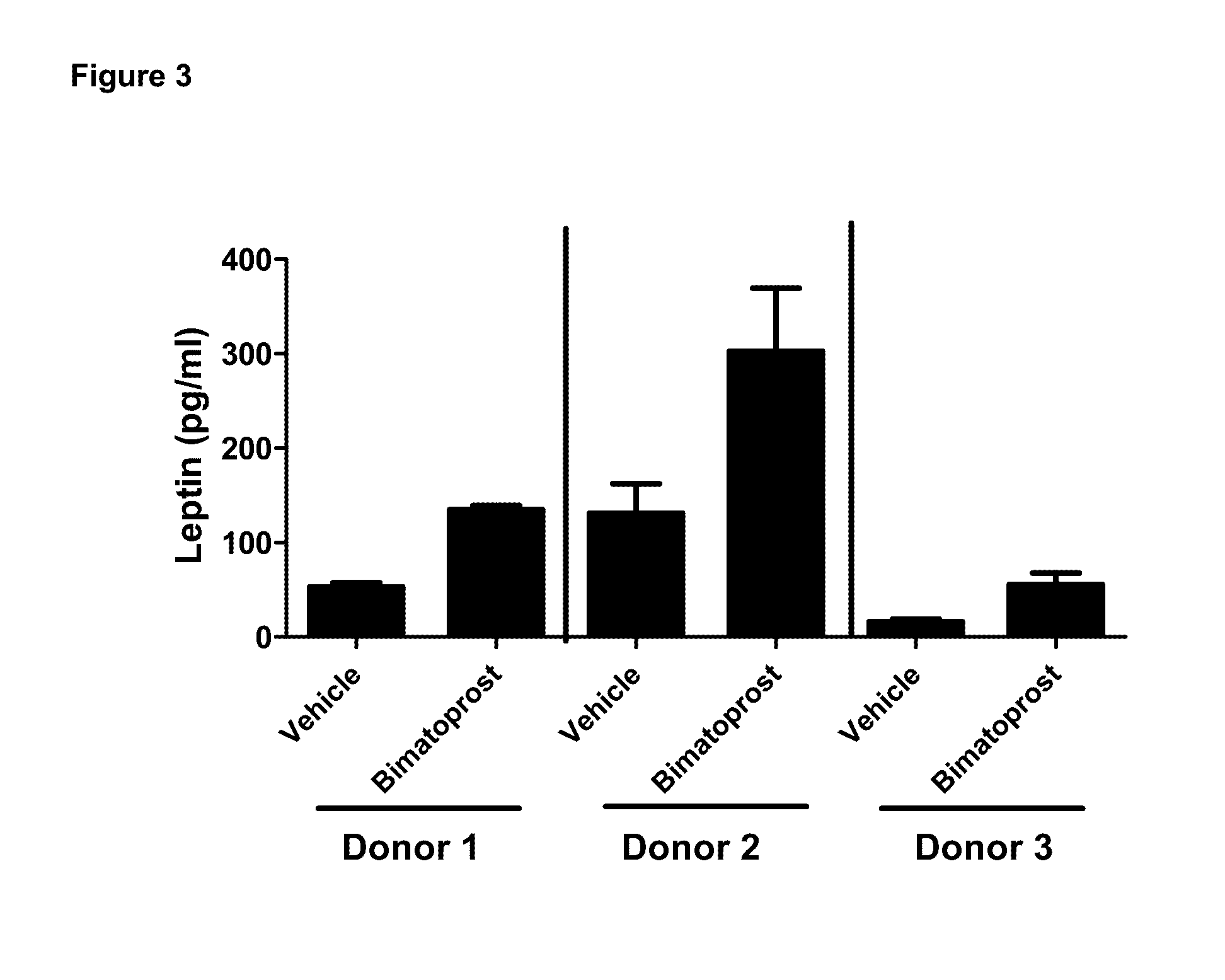 Prostamides for enhancement of leptin production