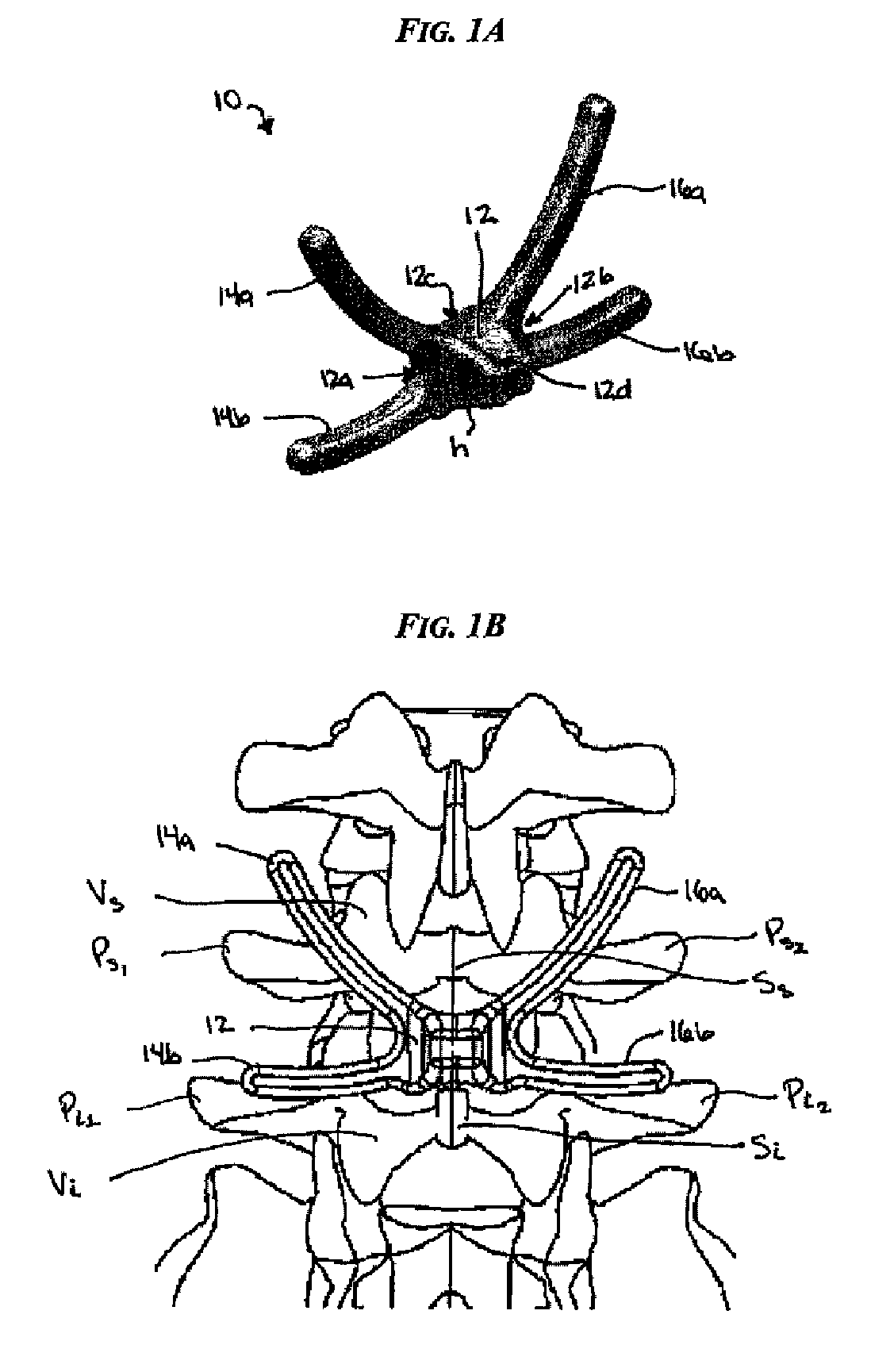 Multi-level posterior dynamic stabilization systems and methods