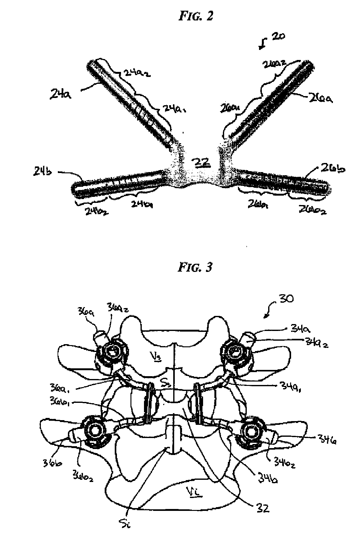 Multi-level posterior dynamic stabilization systems and methods