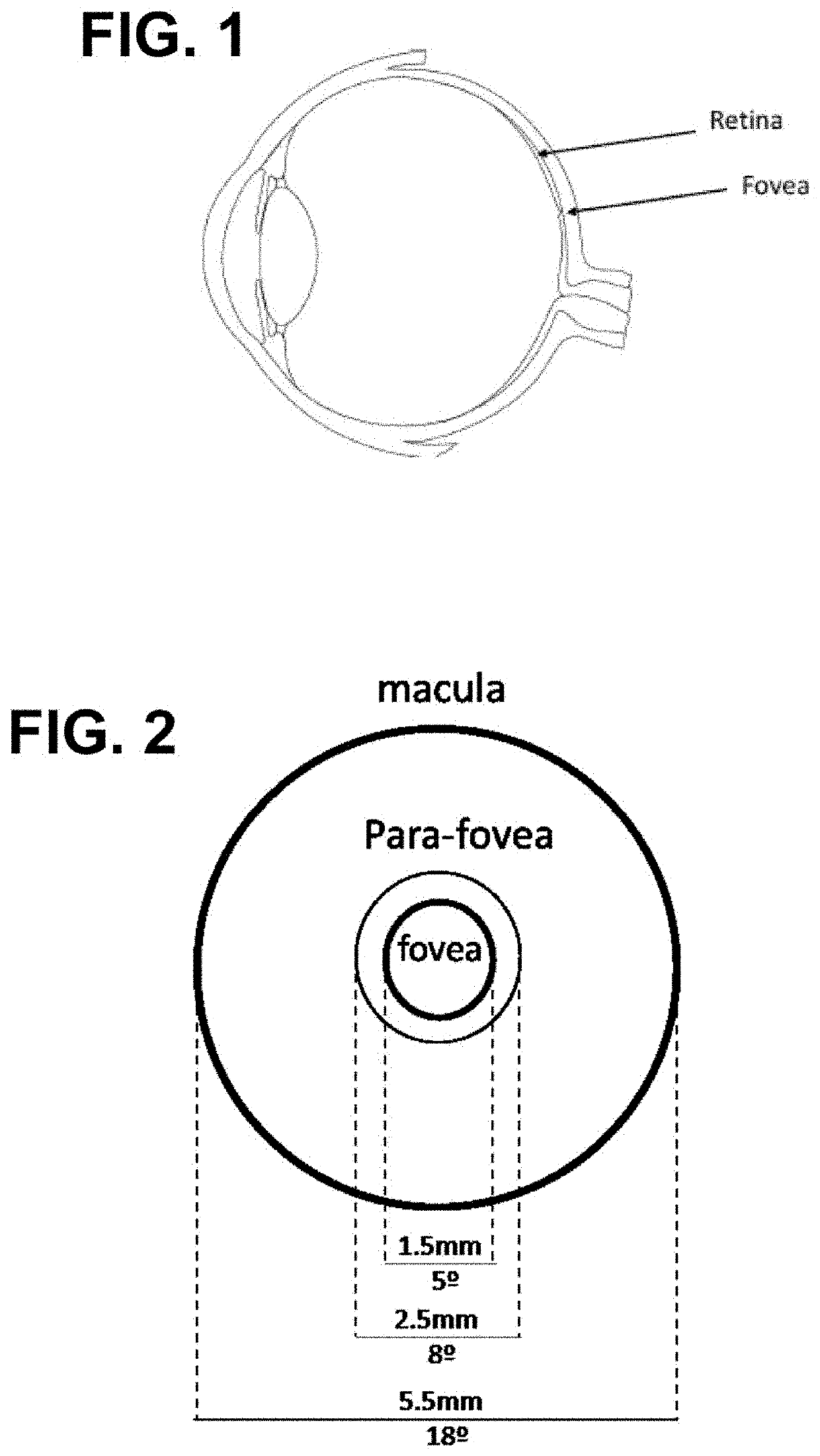 Progressive ophthalmic lens