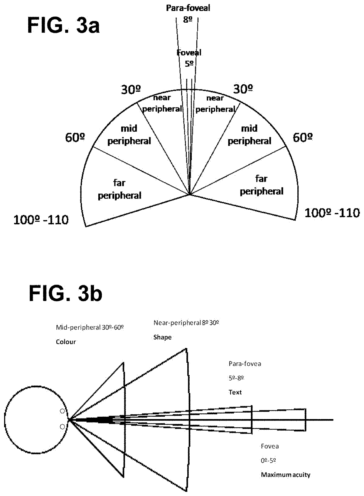 Progressive ophthalmic lens