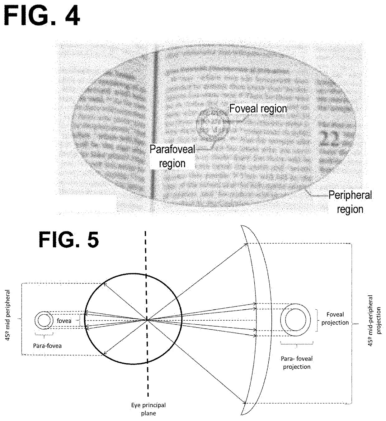 Progressive ophthalmic lens