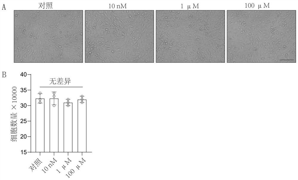 Applin-APJ inhibitor in the application of the application of blood test barrier damage drugs