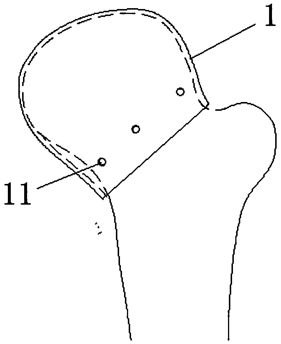Protective structure for protecting human femoral head under pressure