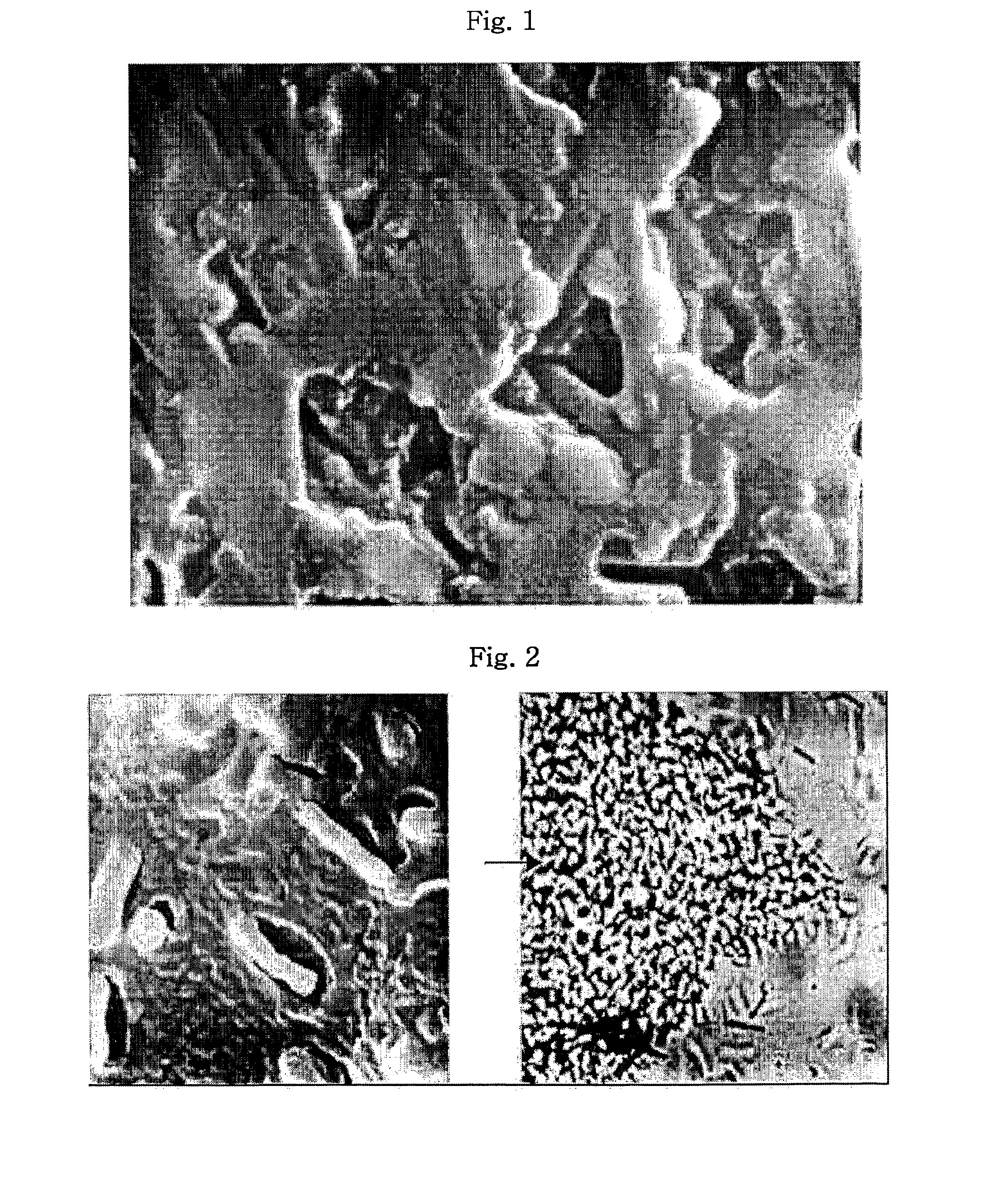 Method of preparing triple-coating lactic acid bacteria and NANO particle coating method, triple-coating lactic acid bacteria prepared thereby and article comprising the same