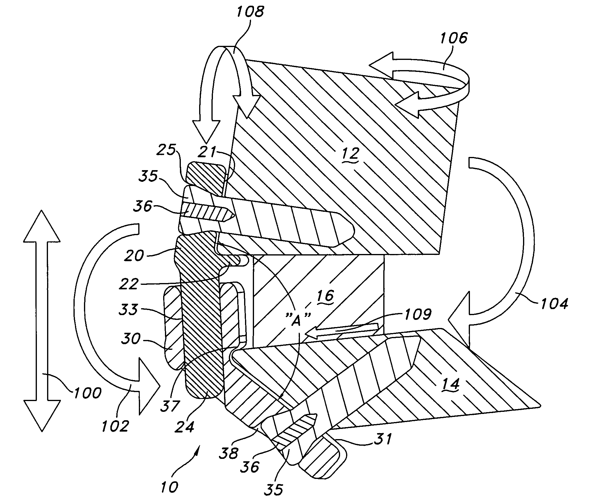 Dynamic stabilization device for anterior lower lumbar vertebral fusion