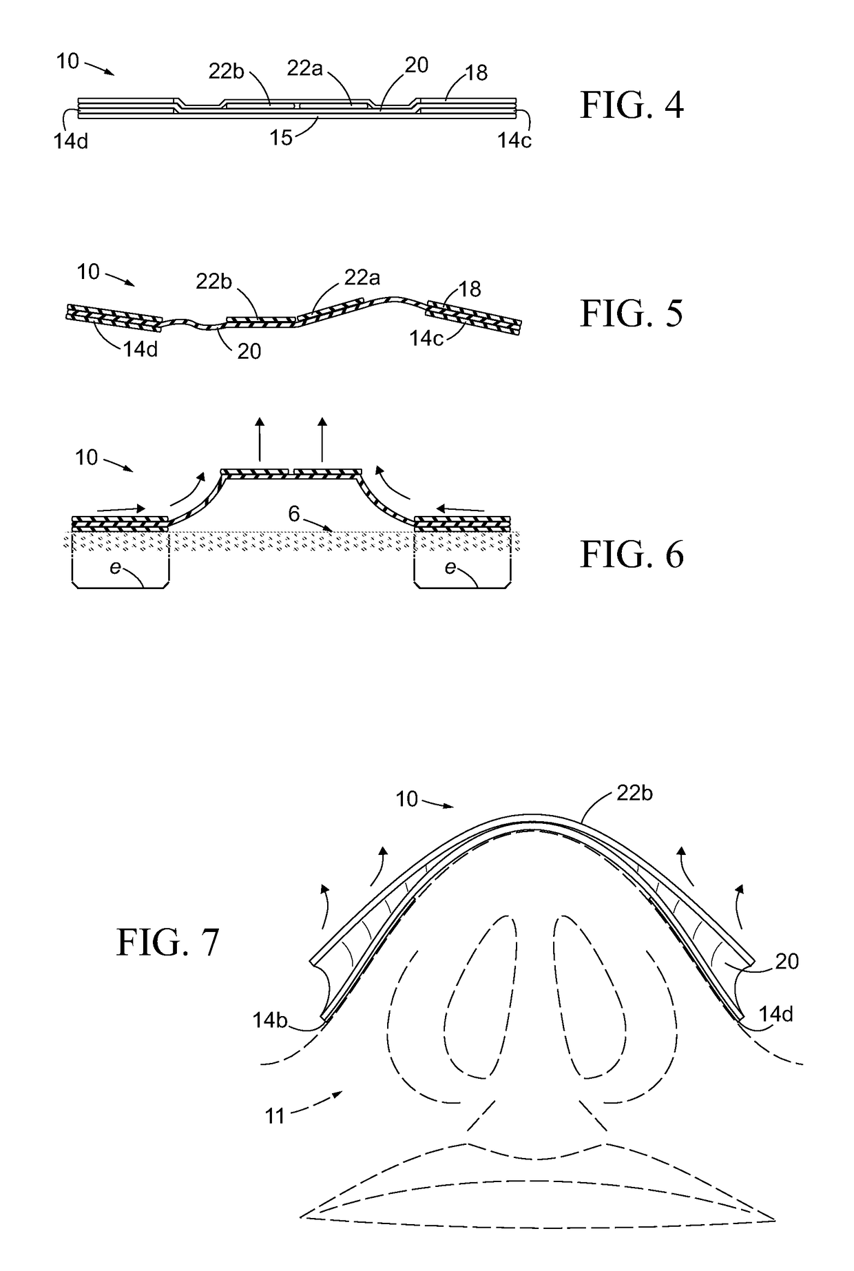 Nasal dilator with elastic membrane structure