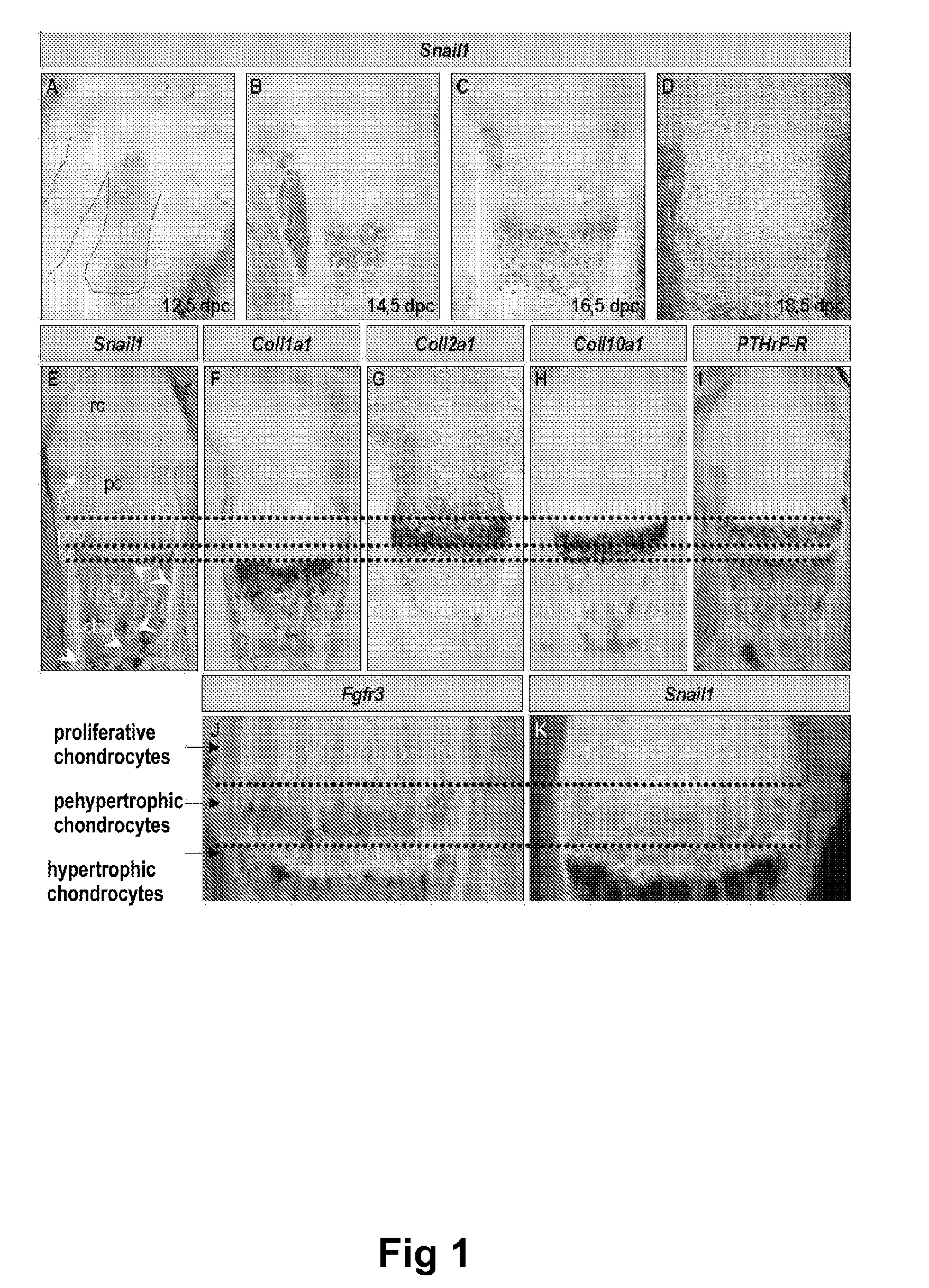 Methods of identifying and using snail1 inhibitory compounds in chondrodysplasia treatment and preparation of pharmaceutical compositions