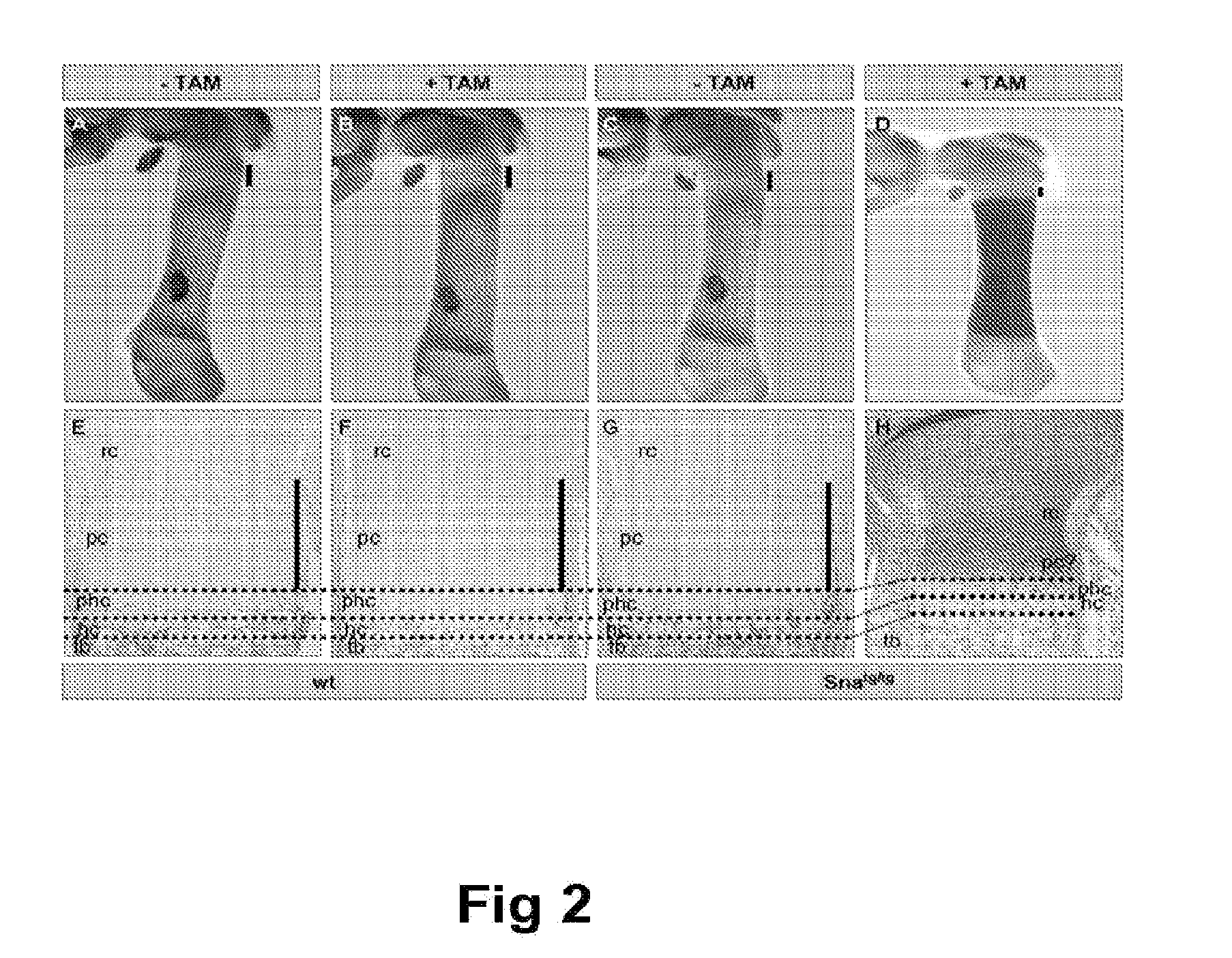 Methods of identifying and using snail1 inhibitory compounds in chondrodysplasia treatment and preparation of pharmaceutical compositions