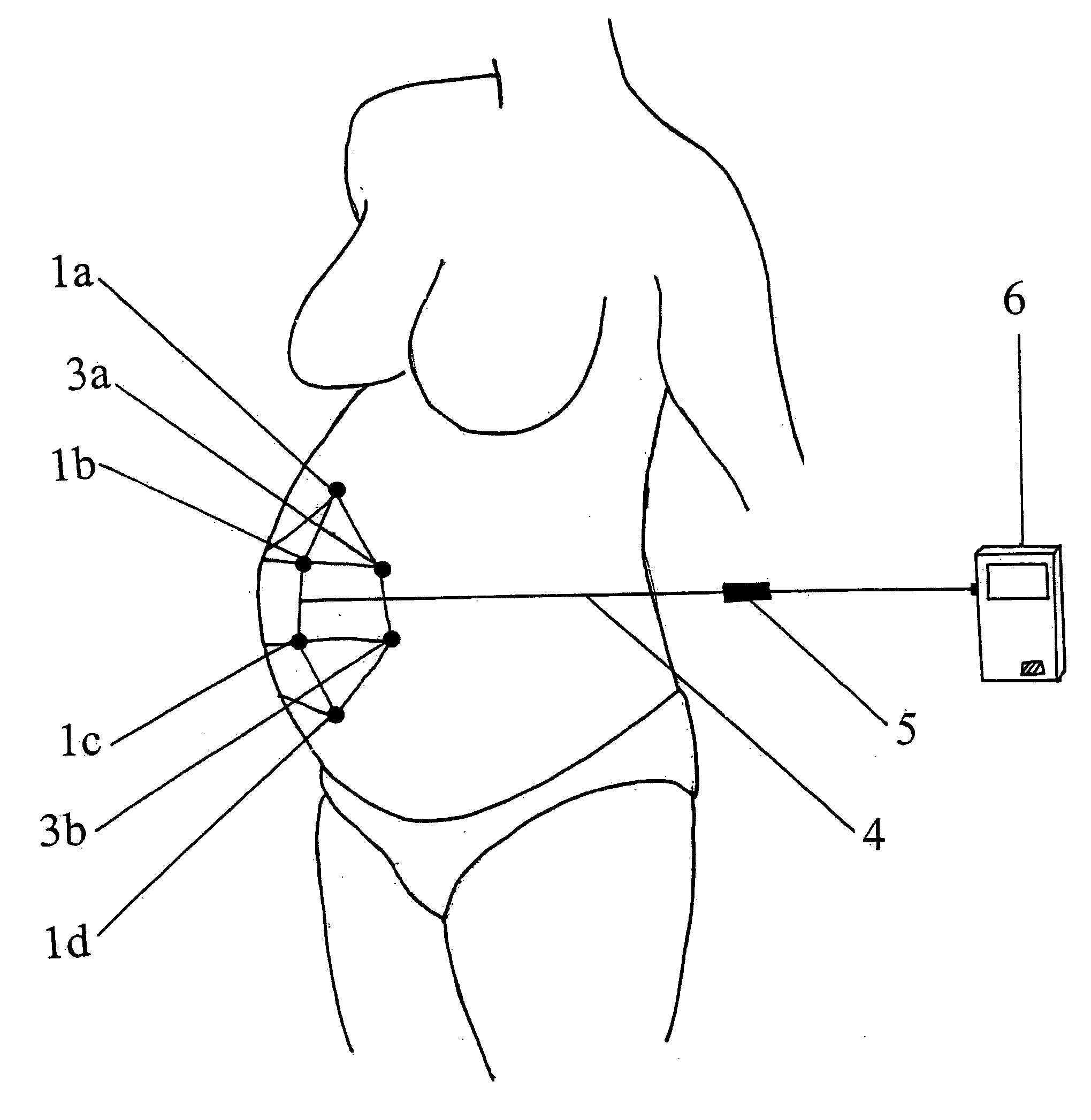 Maternal-fetal monitoring system