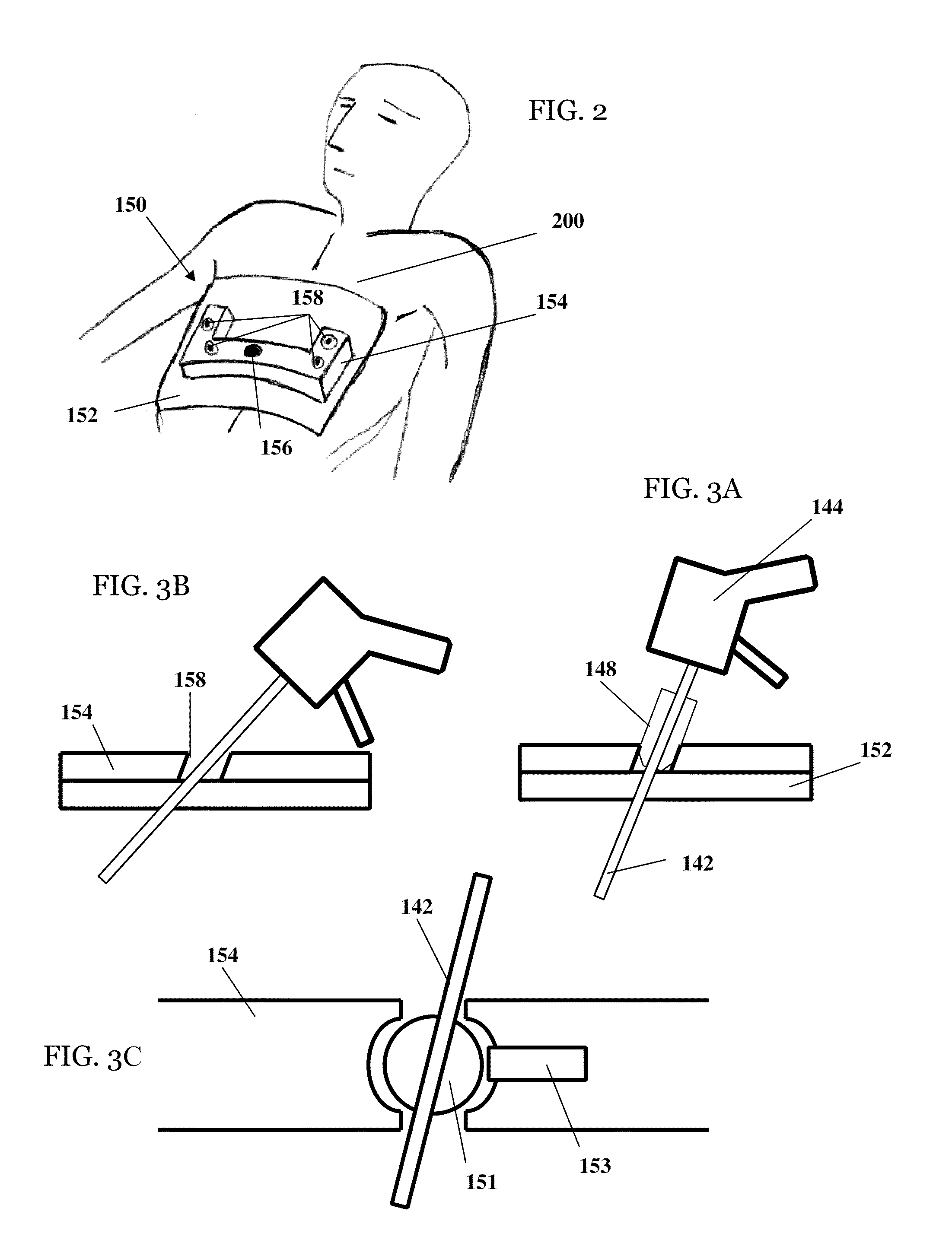 Rapid laparoscopy exchange system and method of use thereof