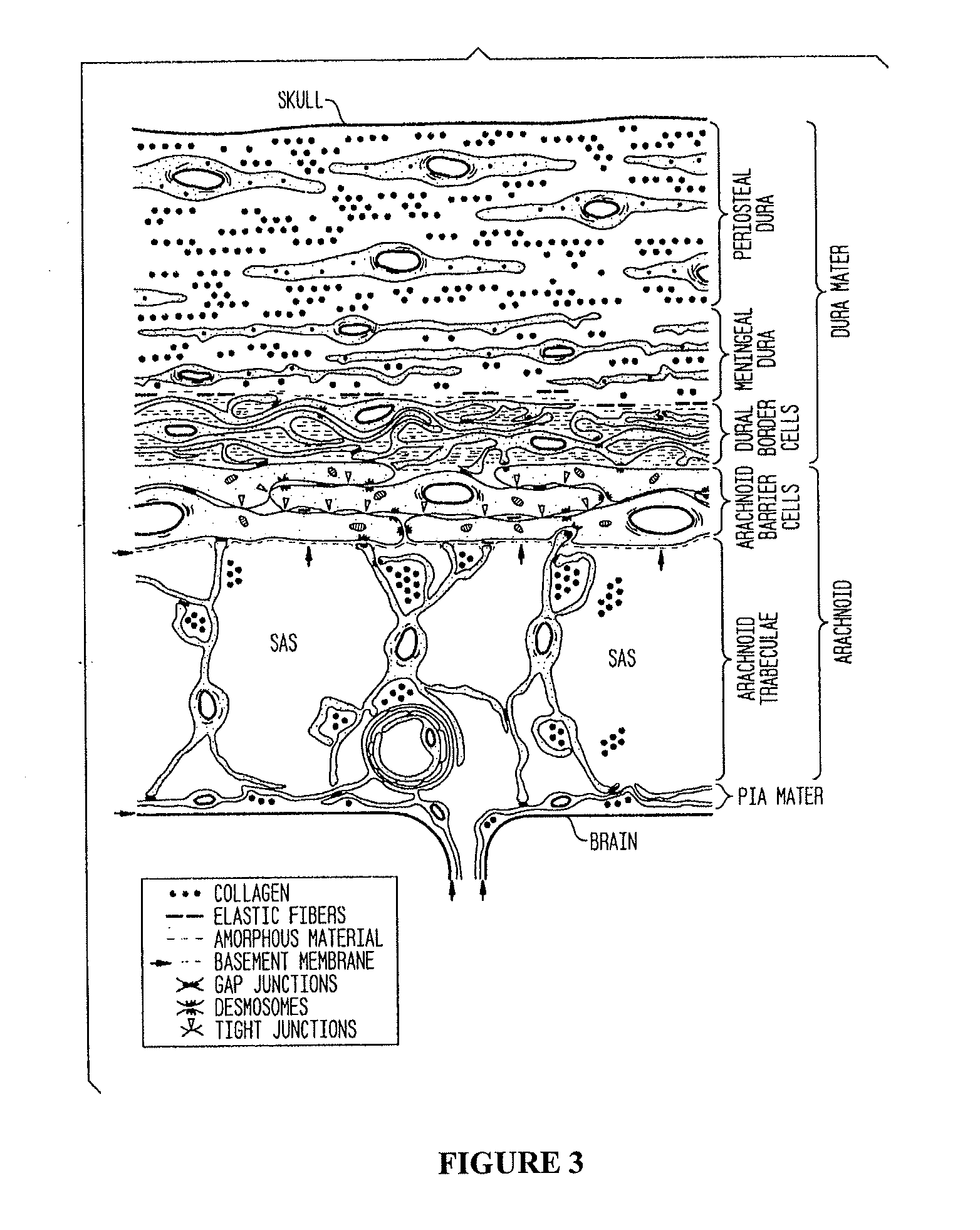 Compositions and their use to treat complications of aneurysmal subarachnoid hemmorrhage