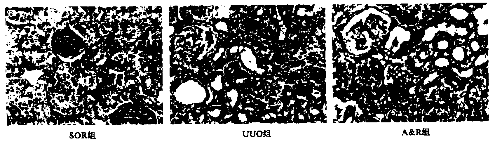 Medicine composite for treating chronic kidney diseases and preparation method and application of medicine composite