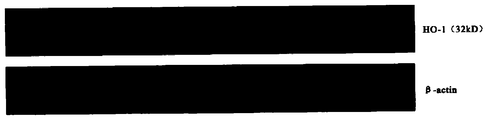 Medicine composite for treating chronic kidney diseases and preparation method and application of medicine composite