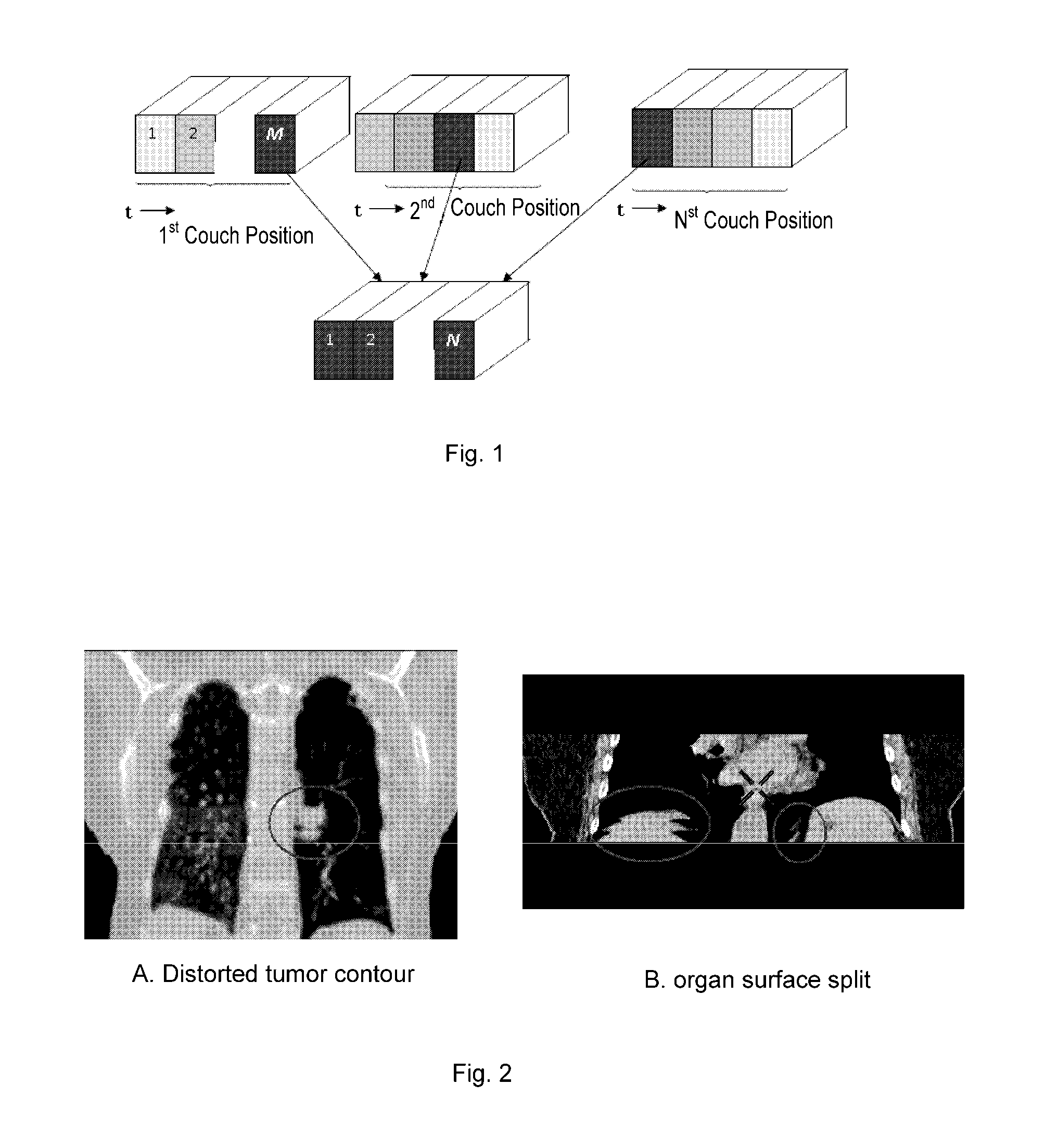 Method for sorting ct image slices and method for constructing 3D ct image