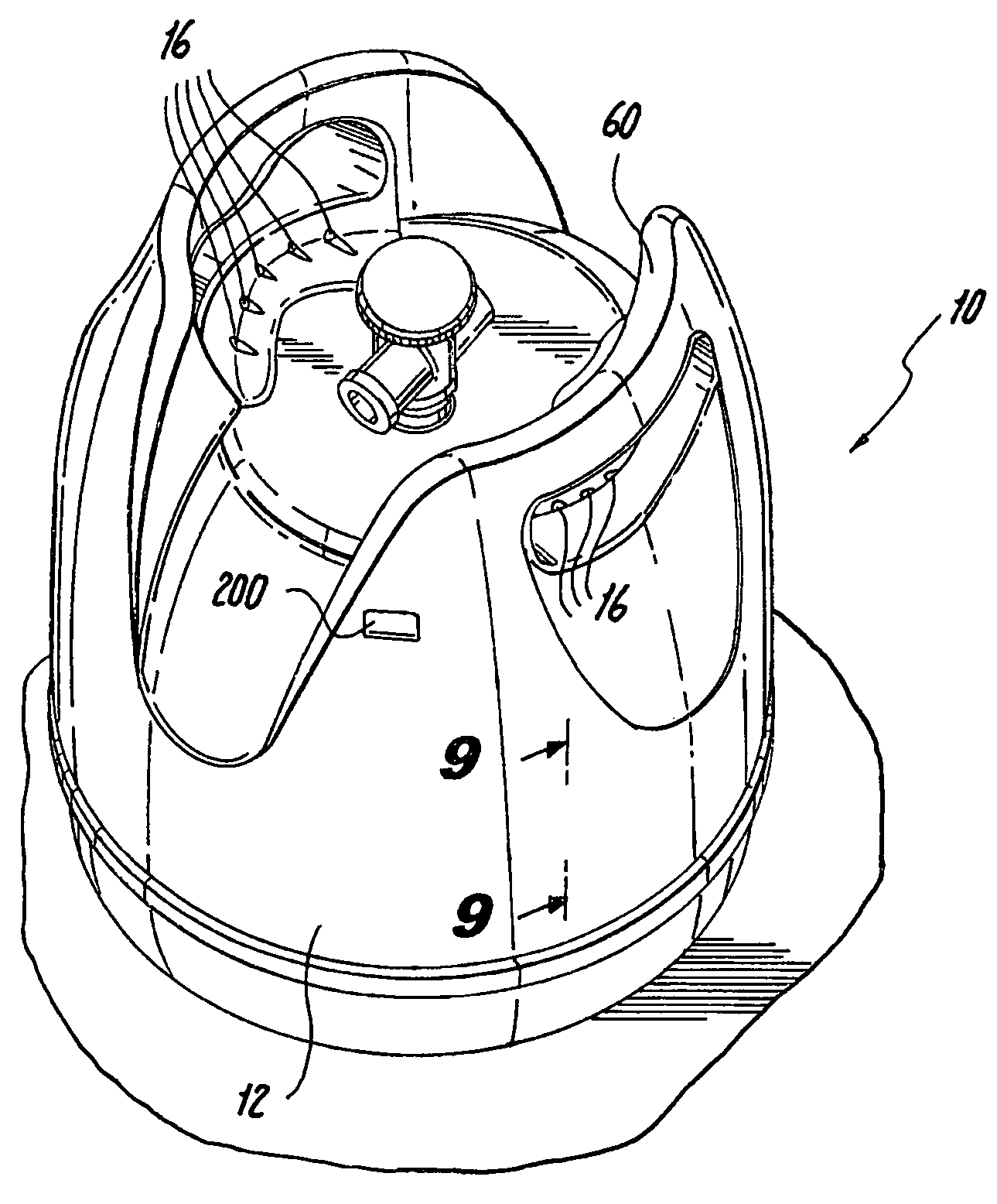 Hybrid pressure vessel with separable jacket