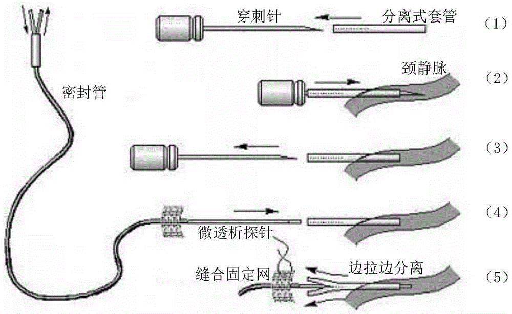 Animal jugular vein microdialysis method