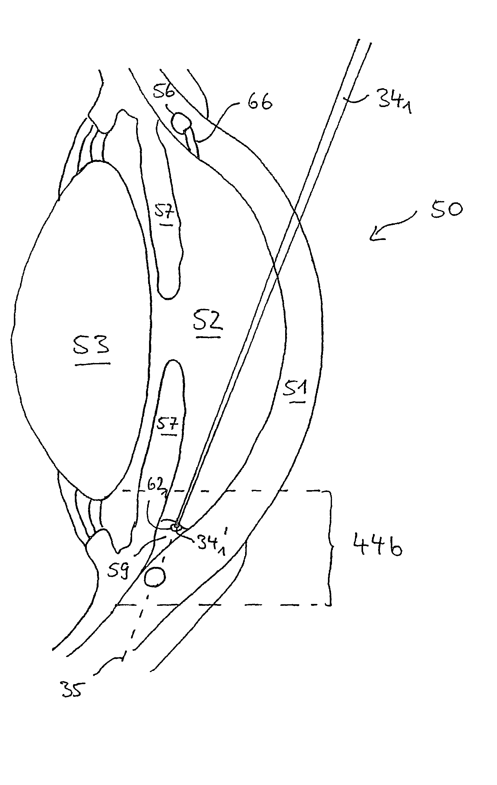 Systems and methods for treating glaucoma and systems and methods for imaging a portion of an eye
