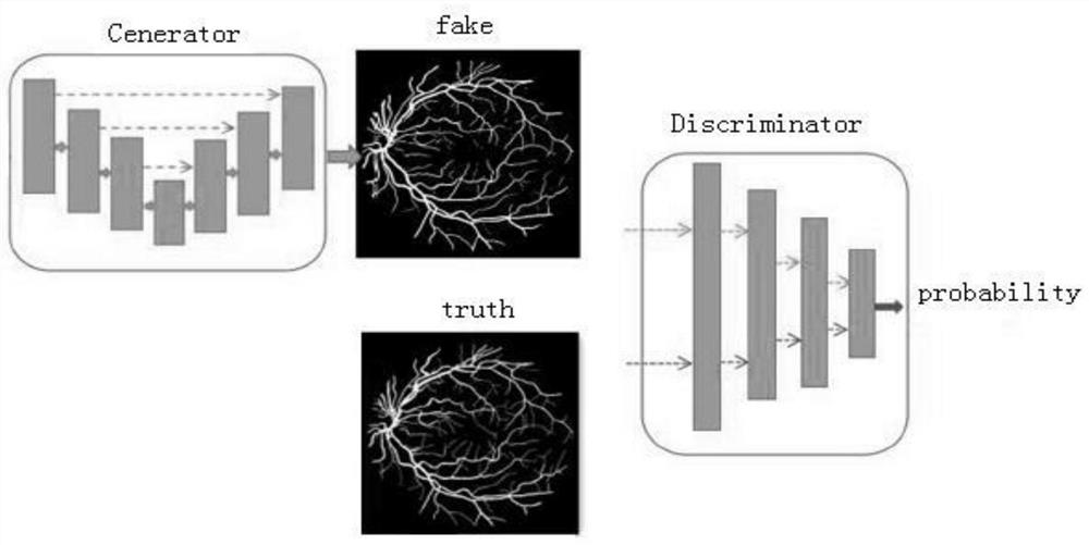 Method for segmenting capillaries in microscopic image based on generative adversarial network