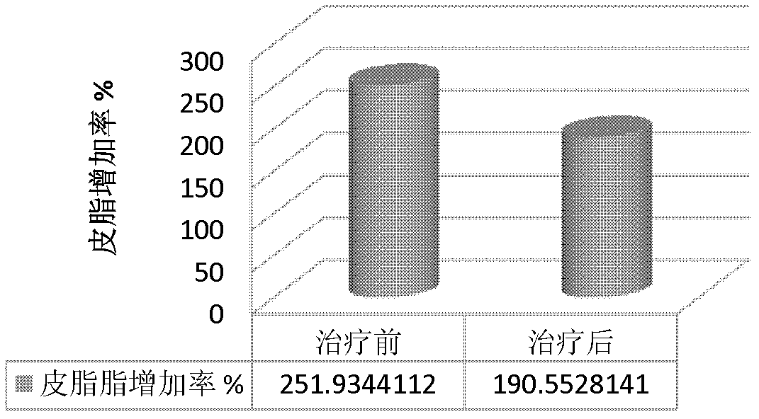 Traditional Chinese medicine composition for improving damp heat constitution, preparation and preparation method thereof