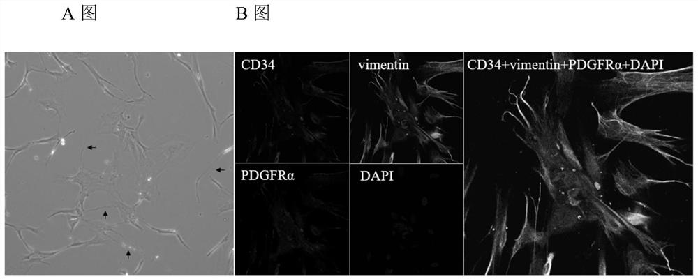 Construction method of human lung teterocyte line