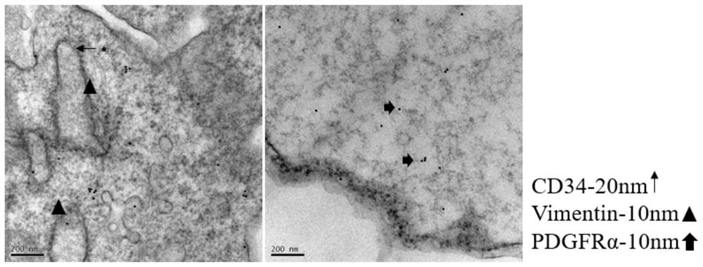 Construction method of human lung teterocyte line