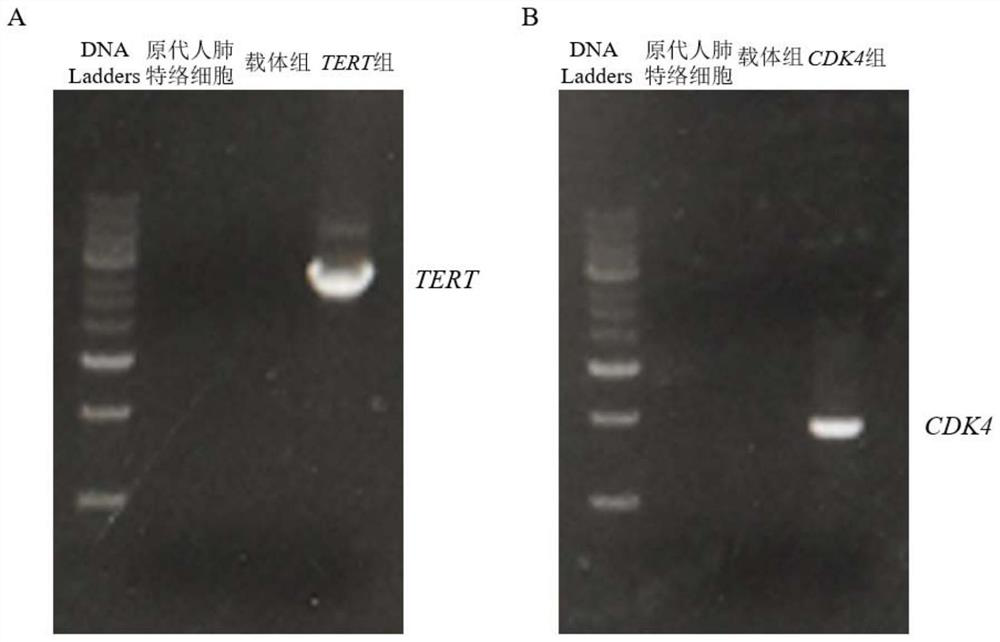 Construction method of human lung teterocyte line