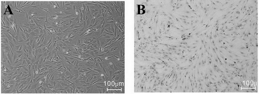 Recoverable immortalized rat bone marrow mesenchyme stem cell as well as preparation method and application thereof