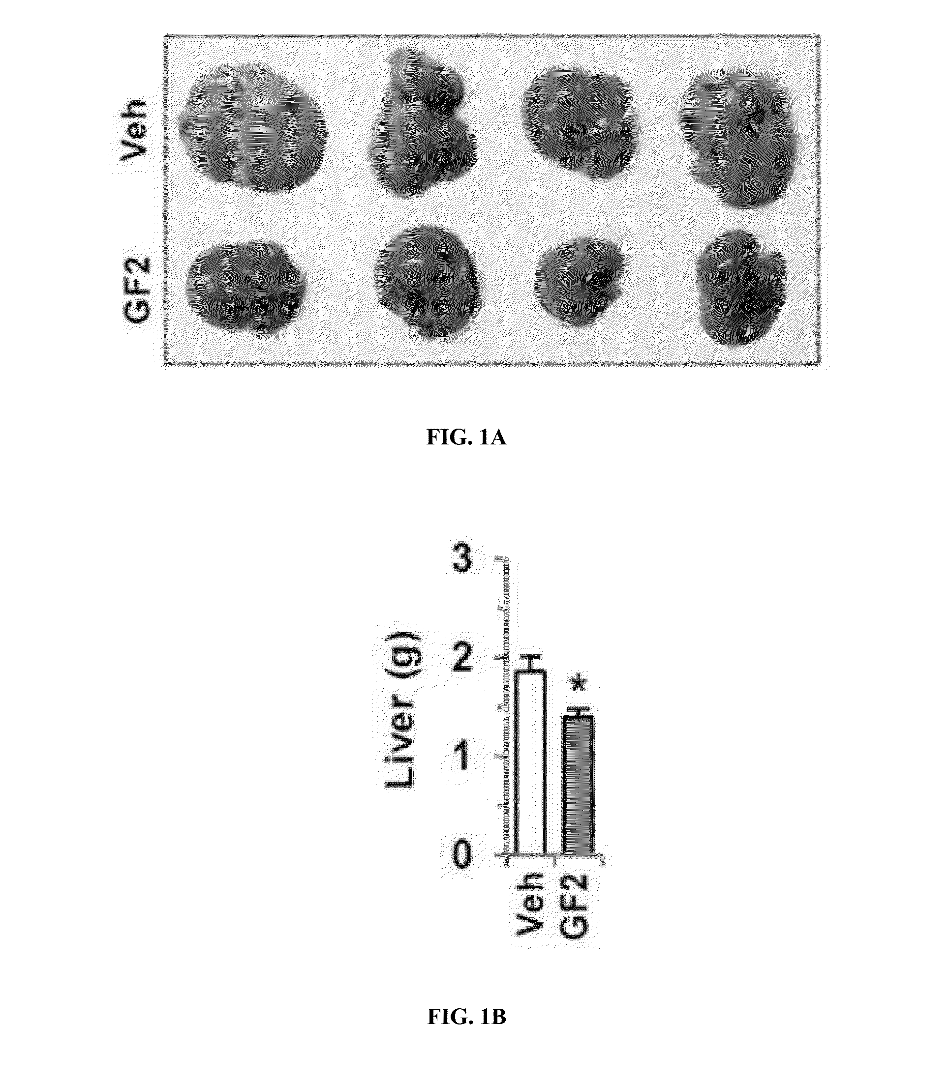Composition for preventing or treating non-alcoholic liver disease or insulin resistance comprising ginsenoside f2