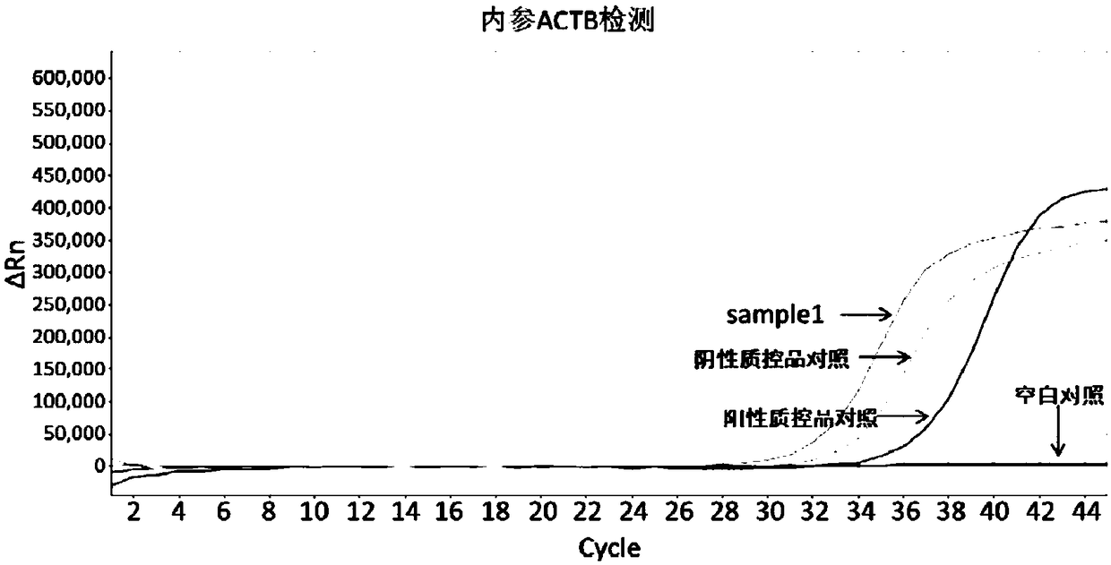 Early diagnosis reagent for colorectal cancer based on combined detection of methylation levels of SDC2 gene and SFRP2 gene