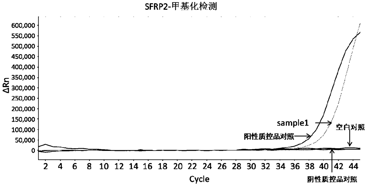 Early diagnosis reagent for colorectal cancer based on combined detection of methylation levels of SDC2 gene and SFRP2 gene