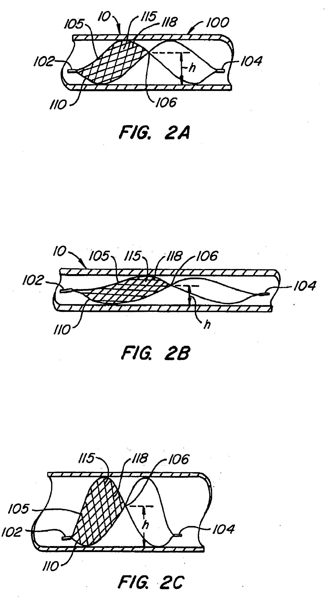 Methods for maintaining a filtering device within a lumen