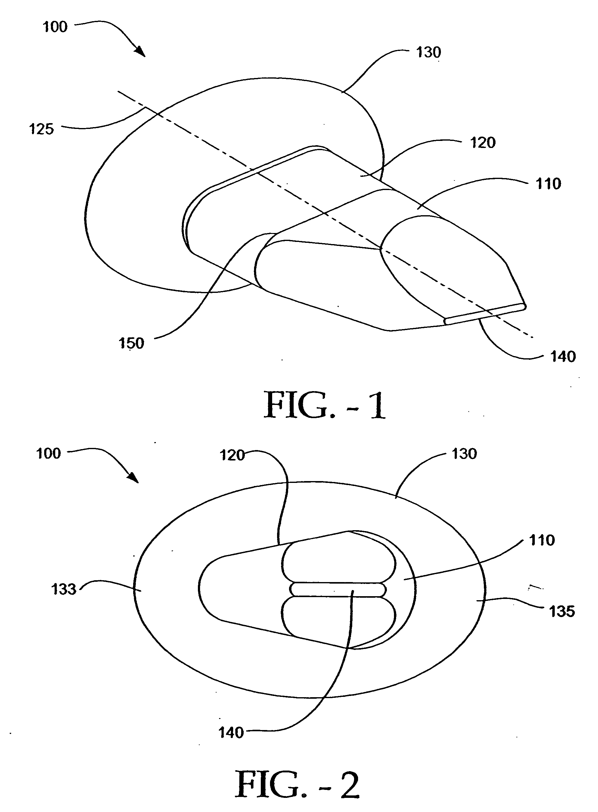 Interspinous process implant with slide-in distraction piece and method of implantation