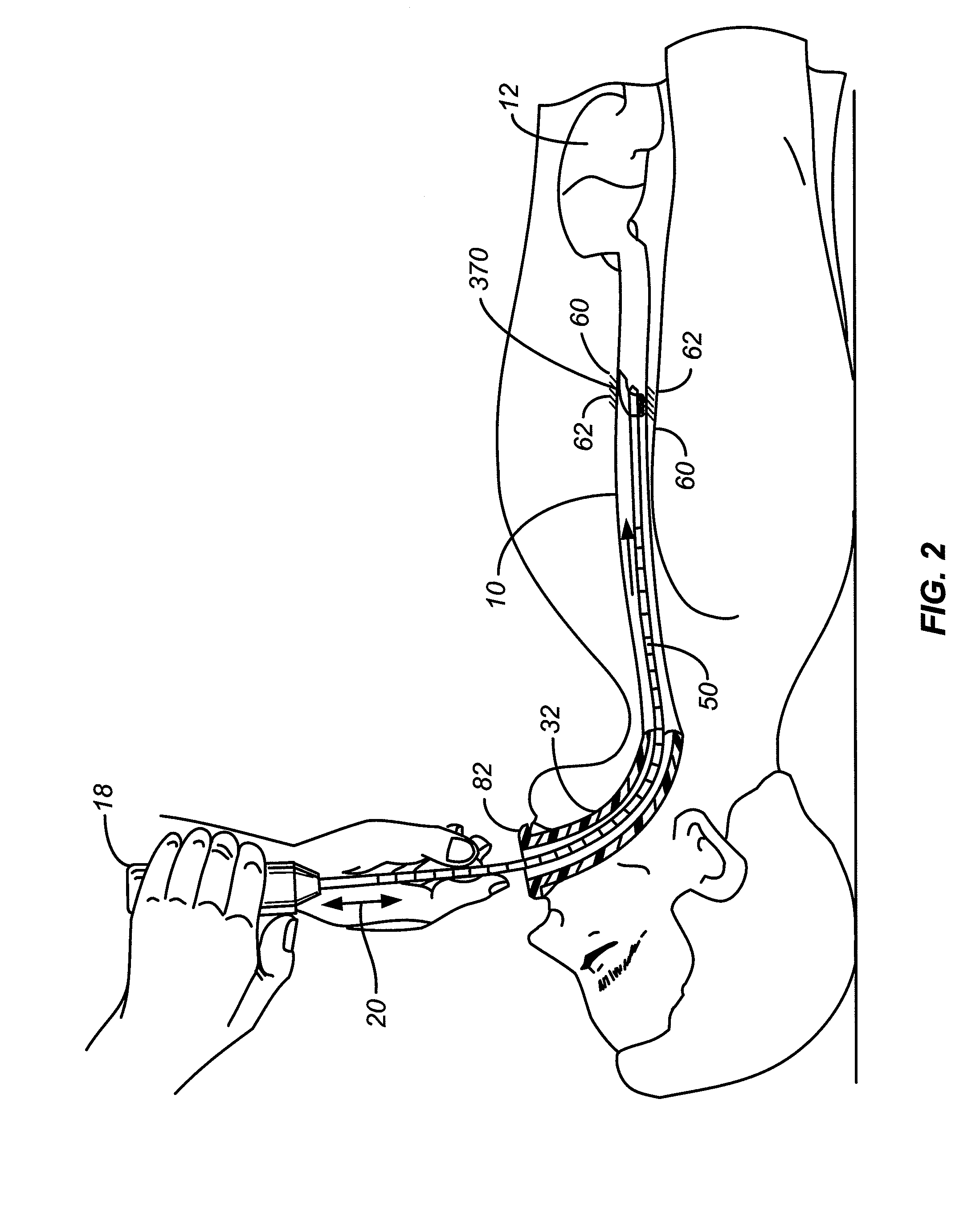 Cleaning device and methods