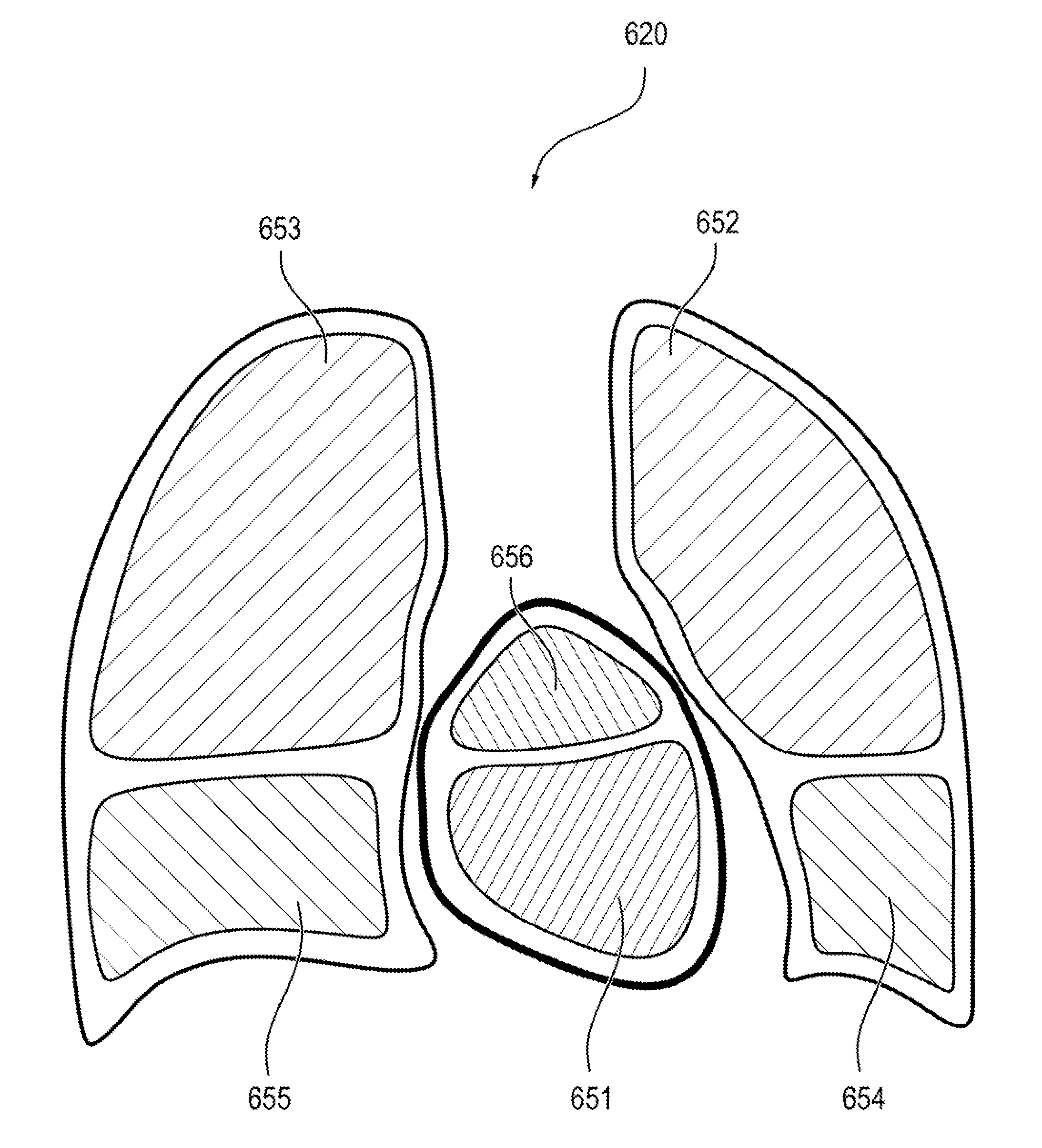 Device and method for processing tomographic data