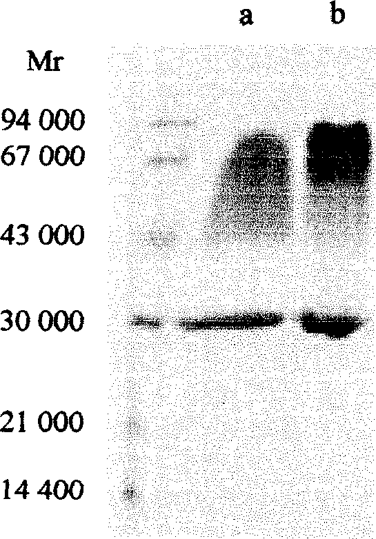 New type mutant of heatlabile enterotoxin from bacteria coli, and preparation method