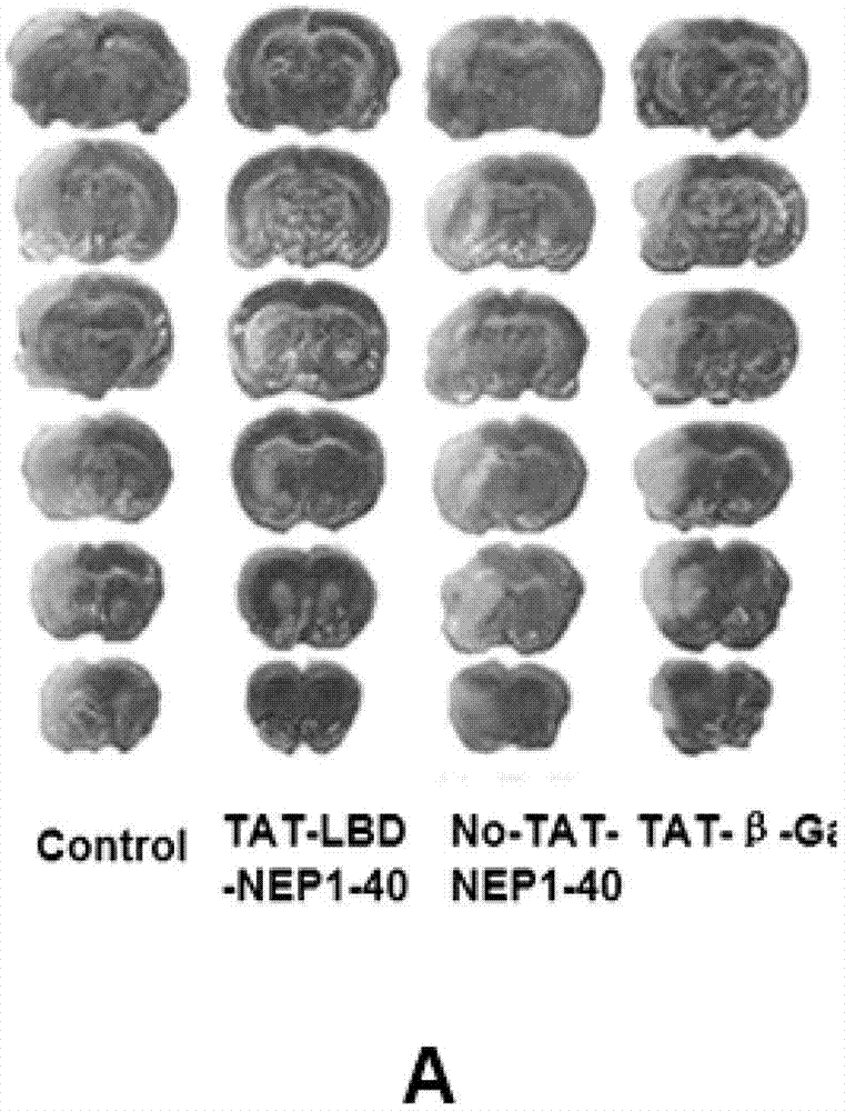 TAT-LBD-NEP1-40 fusion protein, construction method and application thereof