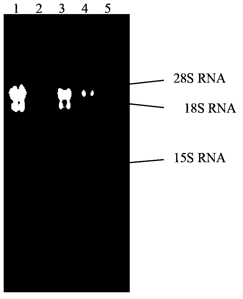 Enzyme of cordyceps sinensis hirsutella sinensis anabolic adenylic acid, gene and application of enzyme