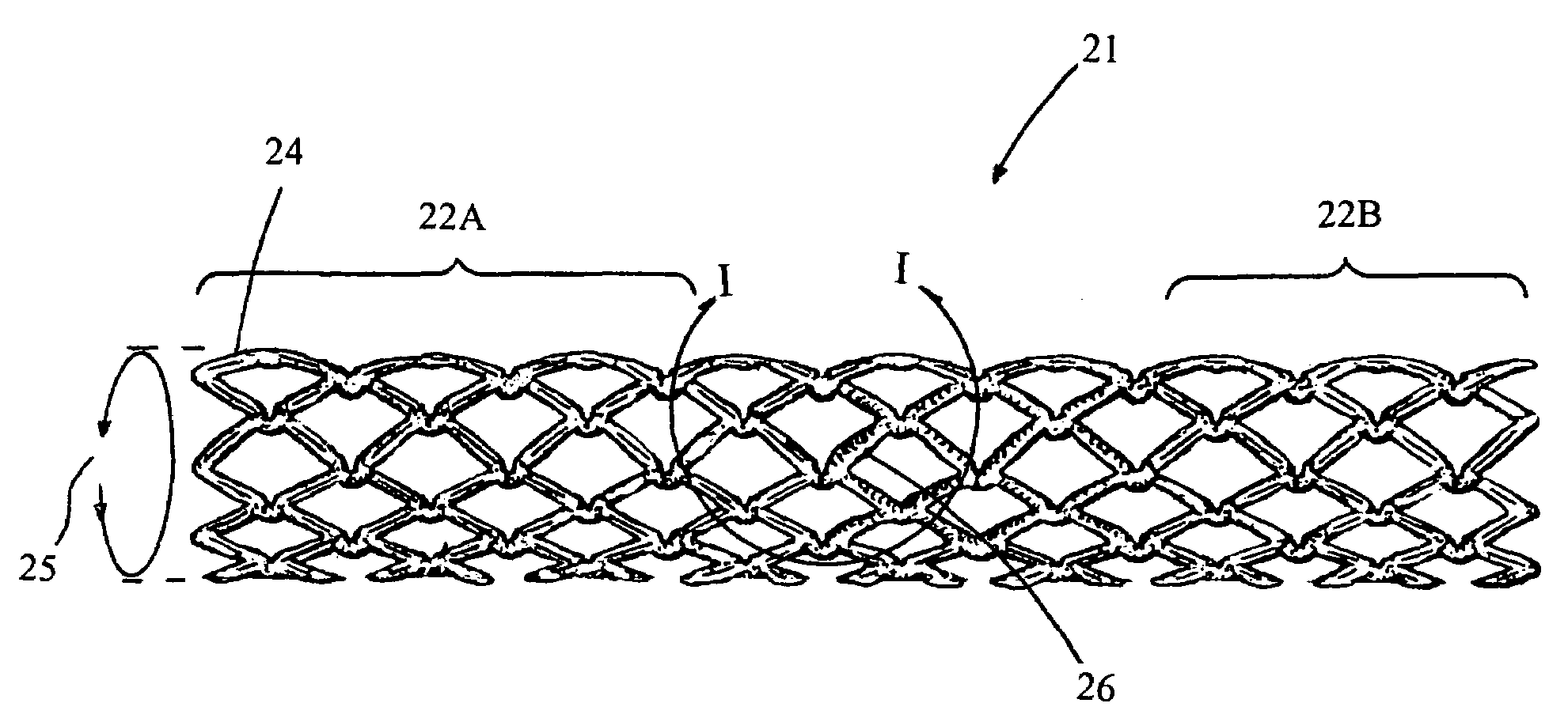 Drug-eluting stent having collagen drug carrier chemically treated with genipin