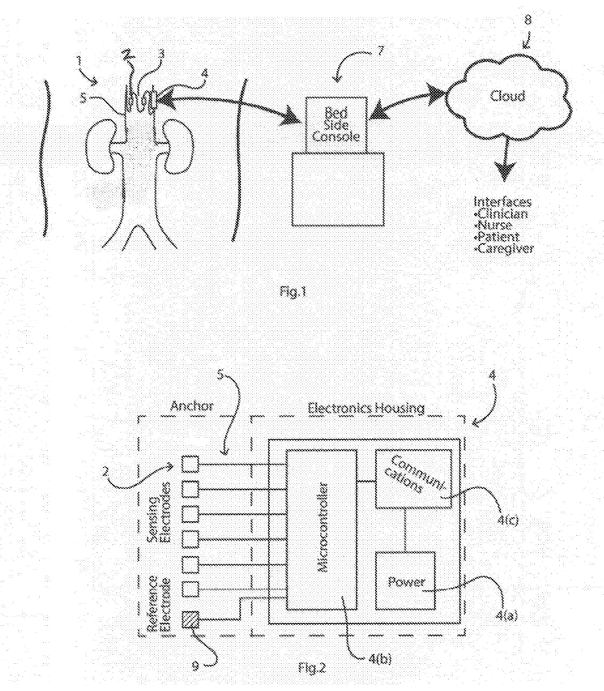 Implantable Sensors for Vascular Monitoring